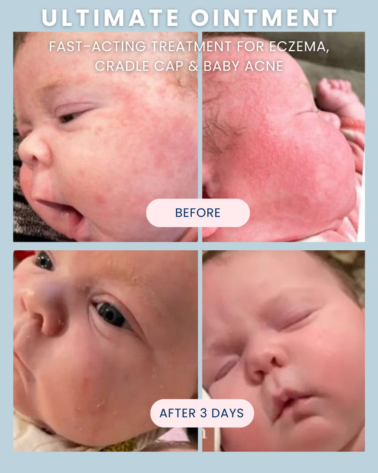 Ultimate Baby Ointment 3.4 oz.