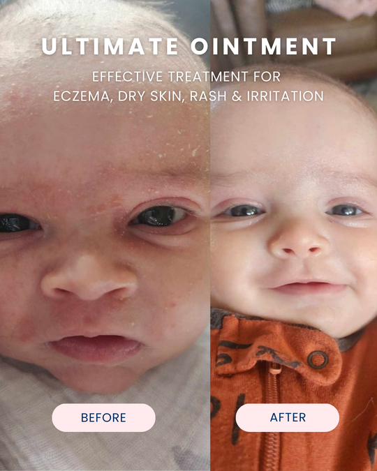 Ultimate Baby Ointment 3.4 oz.
